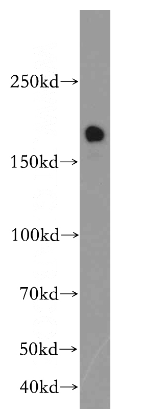HeLa cells were subjected to SDS PAGE followed by western blot with Catalog No:116248(TOP2B antibody) at dilution of 1:300