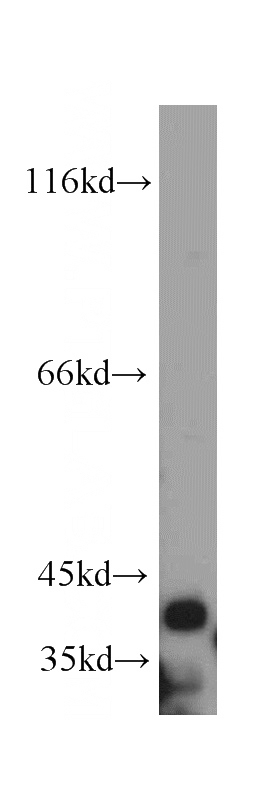 human heart tissue were subjected to SDS PAGE followed by western blot with Catalog No:116320(TRIM54 antibody) at dilution of 1:500