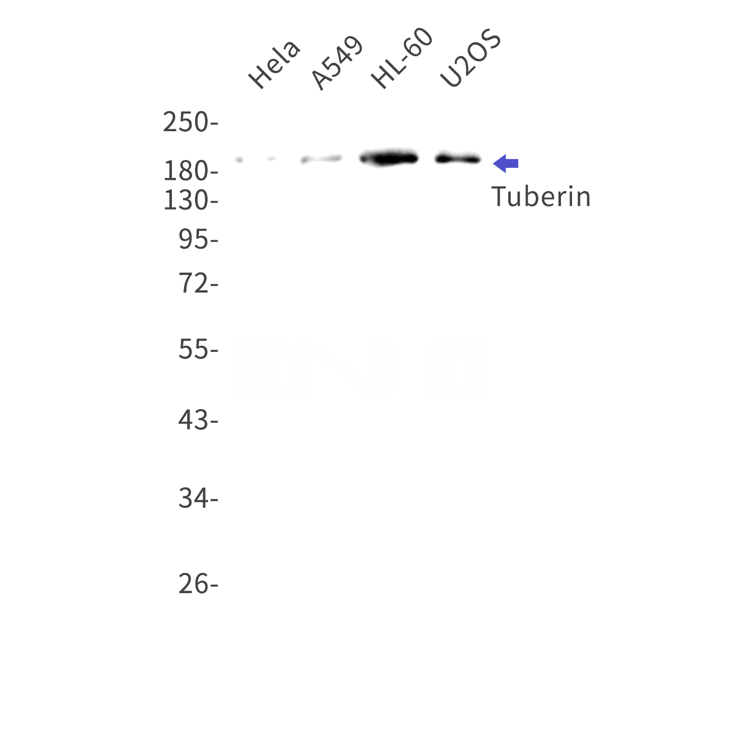 Western blot detection of Tuberin in Hela,A549,HL-60,U2OS cell lysates using Tuberin Rabbit mAb(1:1000 diluted).Predicted band size:201kDa.Observed band size:201kDa.