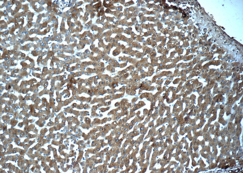 Immunohistochemistry of paraffin-embedded human liver tissue slide using Catalog No:112507(MBL2 Antibody) at dilution of 1:50 (under 10x lens)