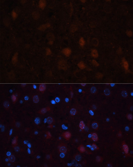 Immunofluorescence - GRIN1 Polyclonal Antibody 