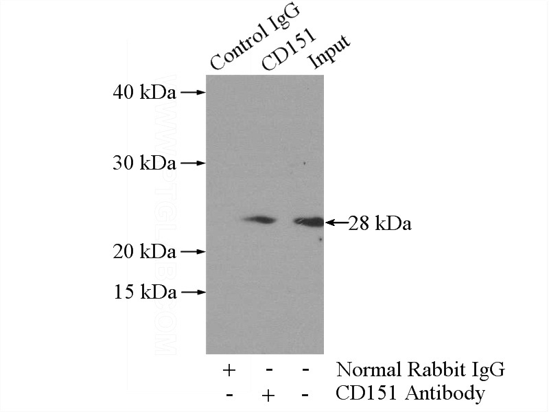 IP Result of anti-CD151 (IP:Catalog No:109056, 3ug; Detection:Catalog No:109056 1:300) with mouse spleen tissue lysate 4000ug.