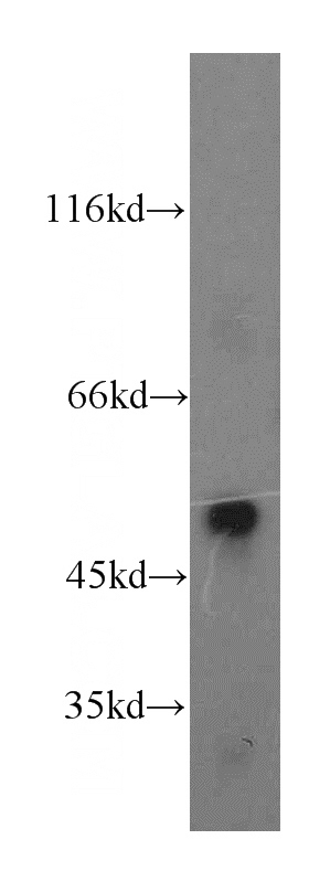 MCF7 cells were subjected to SDS PAGE followed by western blot with Catalog No:112685(MLN64,STARD3 antibody) at dilution of 1:500