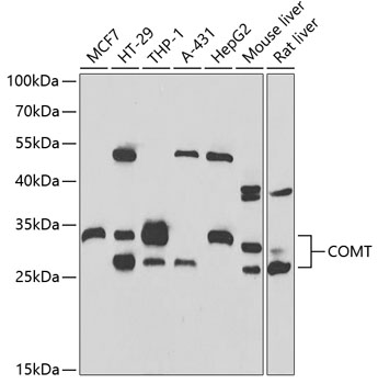 Western blot - COMT Polyclonal Antibody 