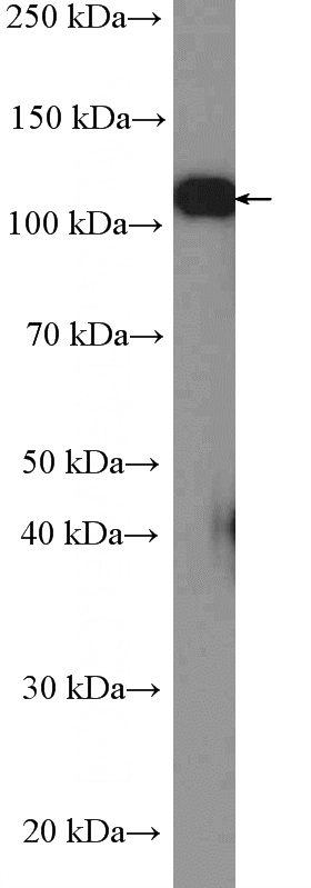 HeLa cells were subjected to SDS PAGE followed by western blot with Catalog No:116755(Vinculin Antibody) at dilution of 1:2000