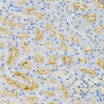 Immunohistochemistry - CDCA8 Polyclonal Antibody 