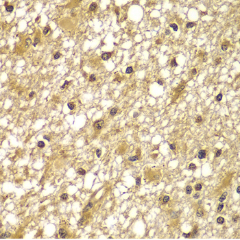 Immunohistochemistry - PIK3R3 Polyclonal Antibody 