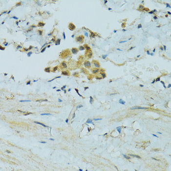 Immunohistochemistry - CYP2B6 Polyclonal Antibody 