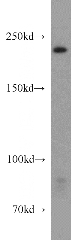 K-562 cells were subjected to SDS PAGE followed by western blot with Catalog No:116641(URB1-Specific antibody) at dilution of 1:800