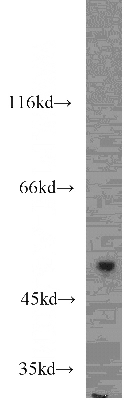 HeLa cells were subjected to SDS PAGE followed by western blot with Catalog No:112441(MAPKAPK5 antibody) at dilution of 1:1000