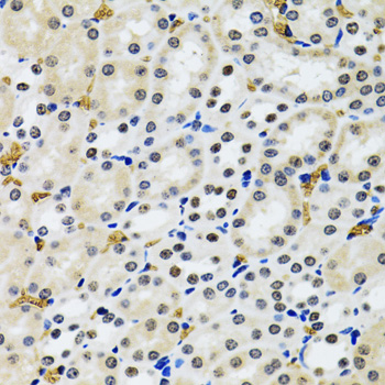 Immunohistochemistry - 53BP1 Polyclonal Antibody 