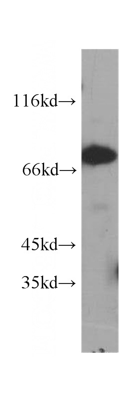 HeLa cells were subjected to SDS PAGE followed by western blot with Catalog No:107556(ABCD1 antibody) at dilution of 1:400