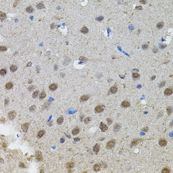 Immunohistochemistry - MYCN Polyclonal Antibody 