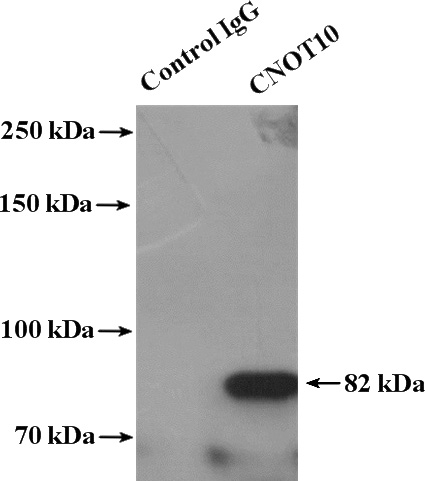 IP Result of anti-CNOT10 (IP:Catalog No:109432, 4ug; Detection:Catalog No:109432 1:300) with mouse brain tissue lysate 5200ug.