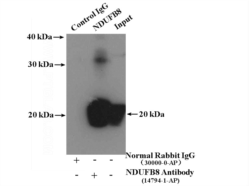 IP Result of anti-NDUFB8 (IP:Catalog No:113077, 4ug; Detection:Catalog No:113077 1:1000) with mouse liver tissue lysate 4000ug.