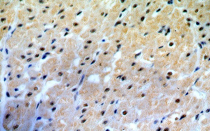 Immunohistochemical of paraffin-embedded human heart using Catalog No:108622(C19orf43 antibody) at dilution of 1:50 (under 40x lens)