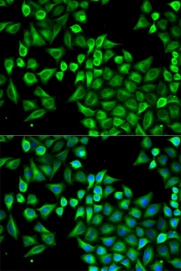 Immunofluorescence - ABAT Polyclonal Antibody 