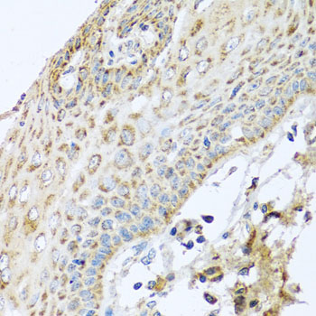 Immunohistochemistry - NDUFA2 Polyclonal Antibody 