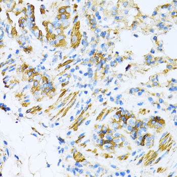 Immunohistochemistry - VAMP1 Polyclonal Antibody 