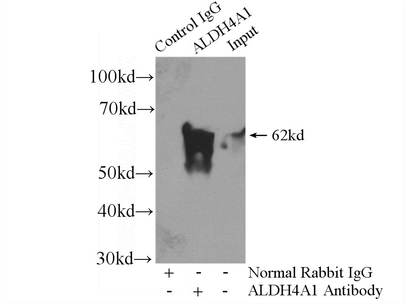 IP Result of anti-ALDH4A1 (IP:Catalog No:107971, 4ug; Detection:Catalog No:107971 1:800) with mouse skeletal muscle tissue lysate 3600ug.
