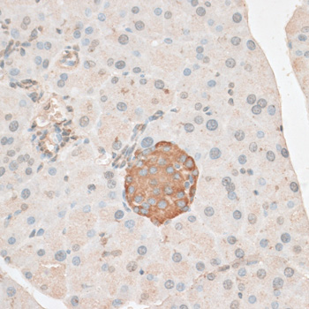 Immunohistochemistry - PDP2 Polyclonal Antibody 