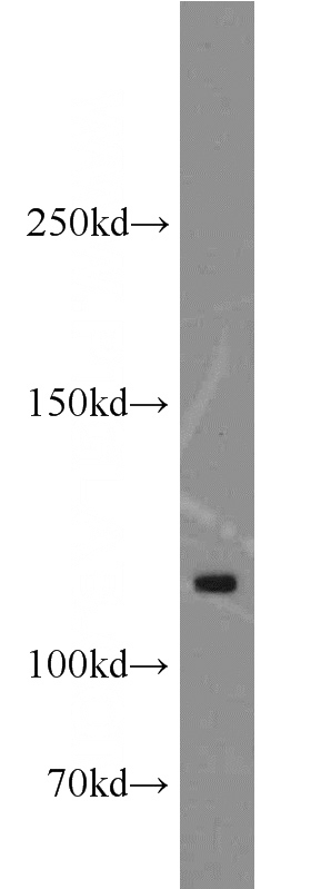 mouse ovary tissue were subjected to SDS PAGE followed by western blot with Catalog No:108102(ANO3 antibody) at dilution of 1:500