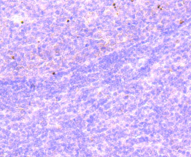Fig4:; Immunohistochemical analysis of paraffin-embedded human tonsil tissue using anti-Histone H2B(mono methyl R79) antibody. Counter stained with hematoxylin.