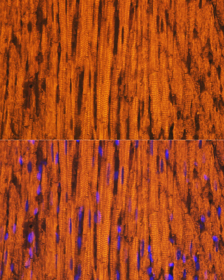 Immunofluorescence - MYH6 Polyclonal Antibody 
