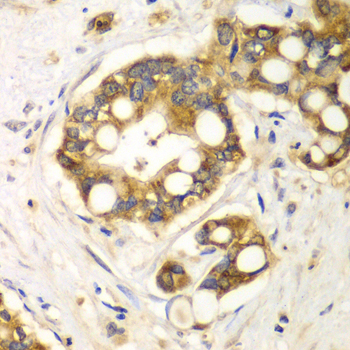 Immunohistochemistry - RPH3A Polyclonal Antibody 