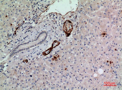Fig2:; Immunohistochemical analysis of paraffin-embedded human-liver, antibody was diluted at 1:100