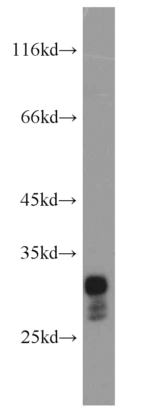 mouse pancreas tissue were subjected to SDS PAGE followed by western blot with Catalog No:114424(RAB26 antibody) at dilution of 1:300