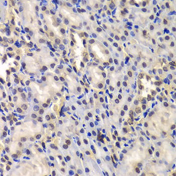 Immunohistochemistry - DDX41 Polyclonal Antibody 