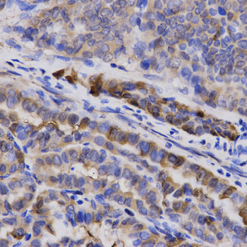 Immunohistochemistry - SNCG Polyclonal Antibody 