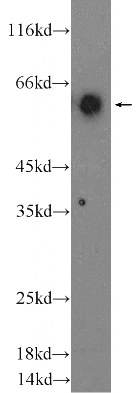 Human peripheral blood leukocyte cells were subjected to SDS PAGE followed by western blot with Catalog No:109139(B7-1 Antibody) at dilution of 1:300