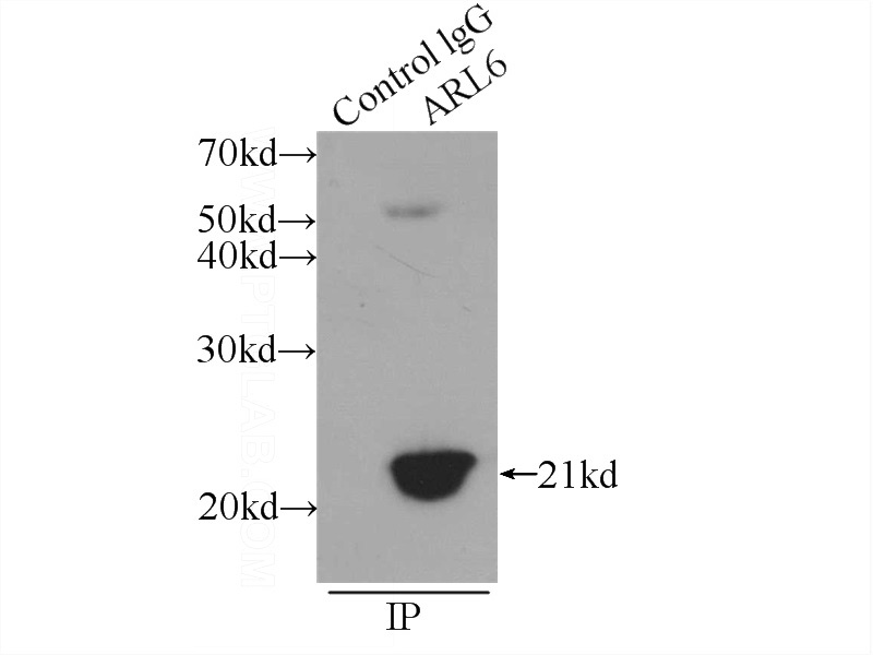 IP Result of anti-BBS3 (IP:Catalog No:108370, 3ug; Detection:Catalog No:108370 1:600) with rat brain tissue lysate 5200ug.