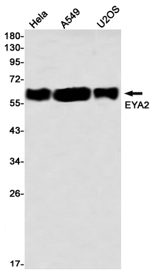 Western blot detection of EYA2 in Hela,A549,U2OS using EYA2 Rabbit mAb(1:1000 diluted)