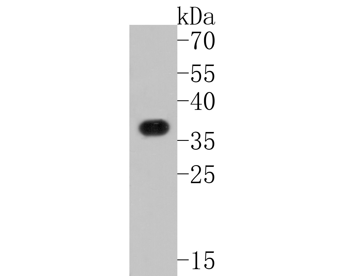 Fig1:; Western blot analysis of XRCC2 on mouse brain tissue lysates. Proteins were transferred to a PVDF membrane and blocked with 5% BSA in PBS for 1 hour at room temperature. The primary antibody ( 1/500) was used in 5% BSA at room temperature for 2 hours. Goat Anti-Rabbit IgG - HRP Secondary Antibody (HA1001) at 1:5,000 dilution was used for 1 hour at room temperature.