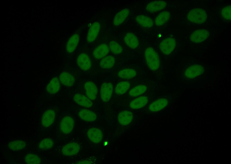 Immunofluorescent analysis of HepG2 cells using Catalog No:107059(ANP32B Antibody) at dilution of 1:50 and Alexa Fluor 488-congugated AffiniPure Goat Anti-Mouse IgG(H+L)