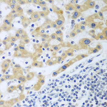 Immunohistochemistry - SHBG Polyclonal Antibody 