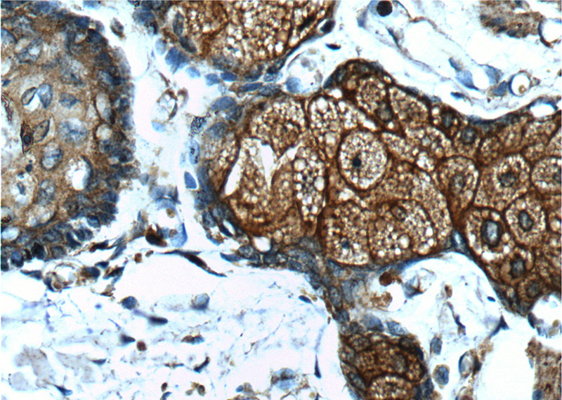 Immunohistochemistry of paraffin-embedded human skin tissue slide using (CD1D Antibody) at dilution of 1:100 (under 40x lens).