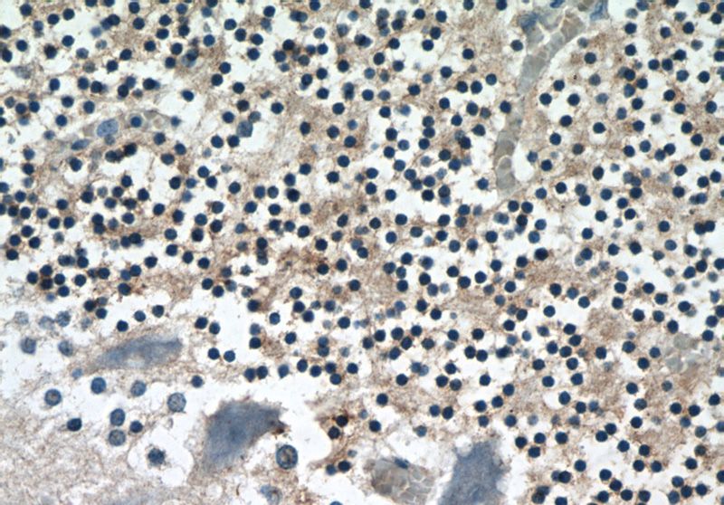 Immunohistochemistry of paraffin-embedded human cerebellum tissue slide using Catalog No:114839(RPS27A Antibody) at dilution of 1:50 (under 40x lens)