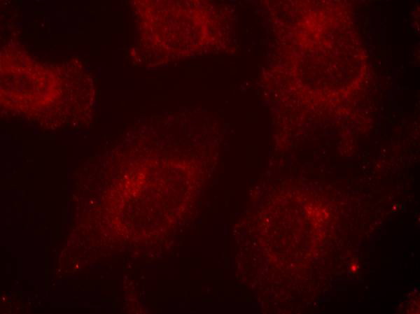 Immunofluorescence staining of methanol-fixed Hela cells using Gab1(Phospho-Tyr627) Antibody .