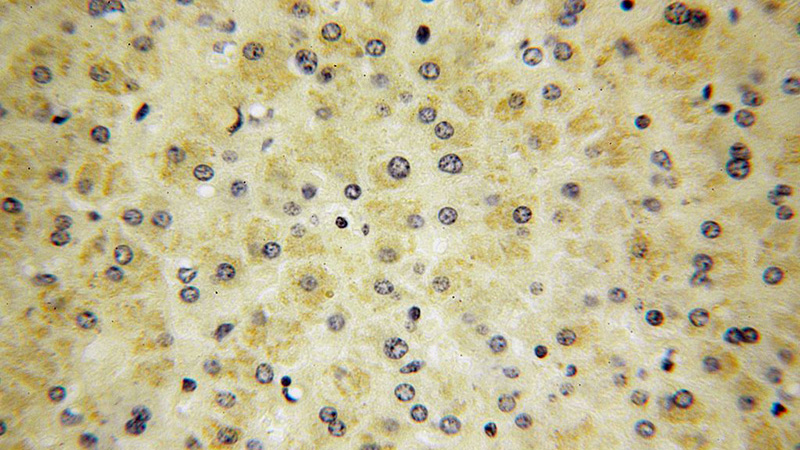 Immunohistochemical of paraffin-embedded human liver using Catalog No:114829(RPS14 antibody) at dilution of 1:200 (under 40x lens)