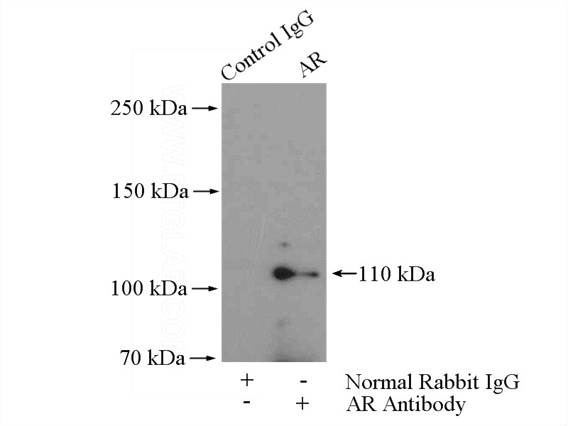 IP Result of anti-AR (IP:Catalog No:108049, 4ug; Detection:Catalog No:108049 1:500) with HepG2 cells lysate 3600ug.