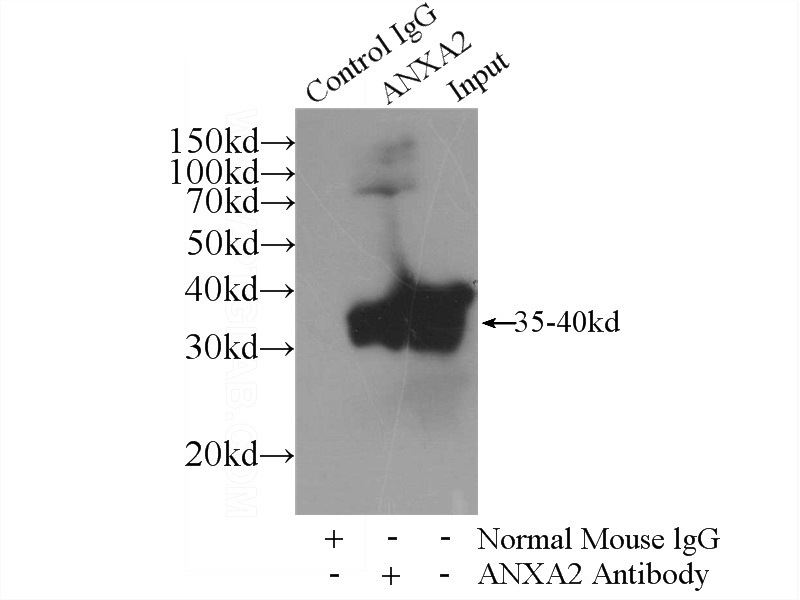IP Result of anti-Annexin A2 (IP:Catalog No:107055, 4ug; Detection:Catalog No:107055 1:1500) with HeLa cells lysate 2400ug.