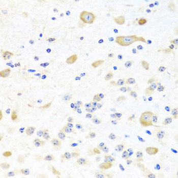 Immunohistochemistry - INPP5K Polyclonal Antibody 