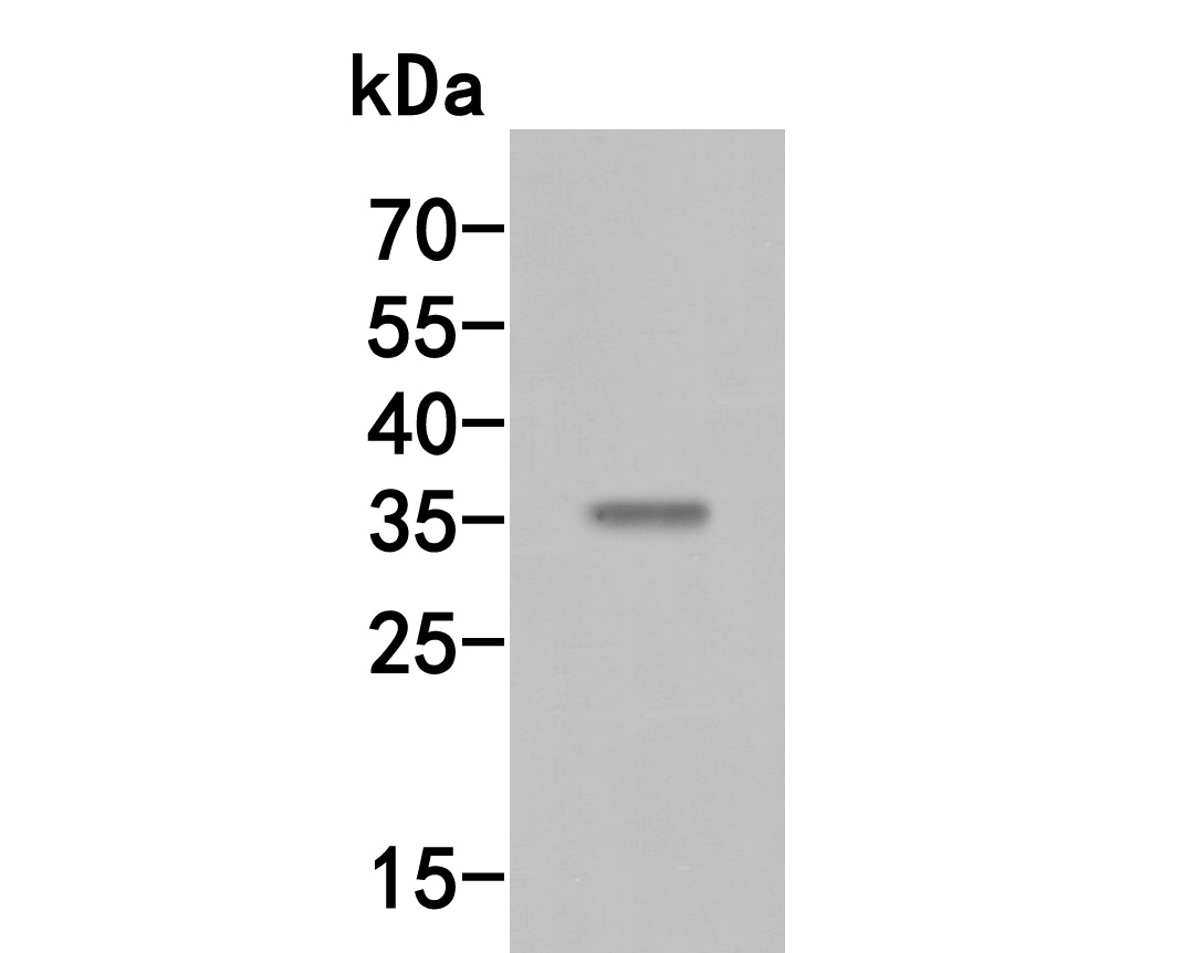 Fig1:; Western blot analysis of MEOX2 on rat kidney tissue lysates. Proteins were transferred to a PVDF membrane and blocked with 5% BSA in PBS for 1 hour at room temperature. The primary antibody ( 1/500) was used in 5% BSA at room temperature for 2 hours. Goat Anti-Rabbit IgG - HRP Secondary Antibody (HA1001) at 1:5,000 dilution was used for 1 hour at room temperature.