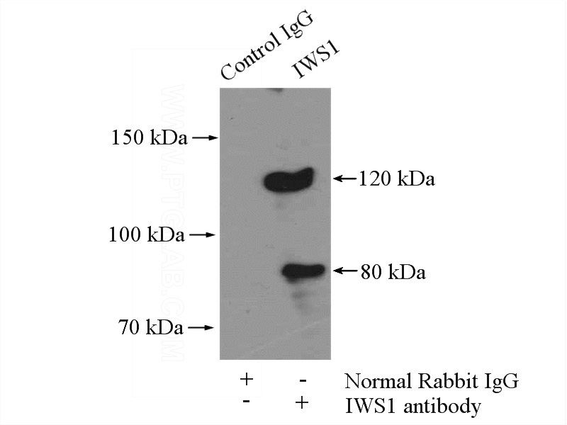 IP Result of anti-IWS1 (IP:Catalog No:111876, 4ug; Detection:Catalog No:111876 1:500) with mouse brain tissue lysate 4000ug.