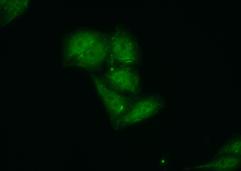Immunofluorescent analysis of (10% Formaldehyde) fixed HepG2 cells using Catalog No:115803(SDCBP Antibody) at dilution of 1:50 and Alexa Fluor 488-congugated AffiniPure Goat Anti-Rabbit IgG(H+L)