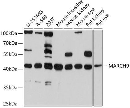 Western blot - MARCH9 Polyclonal Antibody 